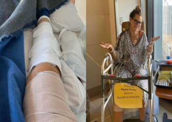 UFC Broken Leg: How Often Does It Happen? (And Whats The Recovery Time?)