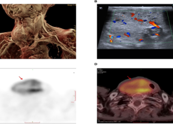 Where can I find qianzhangying and how to download it?